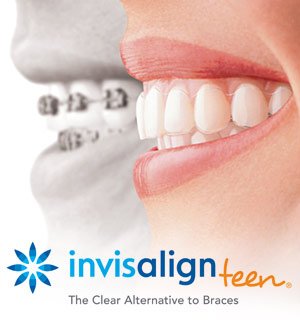 Types of Braces  General and Cosmetic Dentist in Thousand Oaks, CA